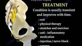 Pudendal Nerve Palsy Bicyclist nerve Injury  Everything You Need To Know  Dr Nabil Ebraheim [upl. by Oakley]