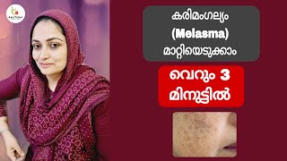 How To Get Rid Of Melasma Naturally In Just 3 Minutes [upl. by Nelli]