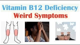 Vitamin B12 Deficiency Weird Symptoms amp Why They Occur [upl. by Nujra]