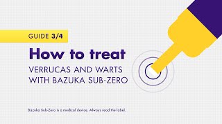 How to treat verrucas and warts with Bazuka SubZero [upl. by Glarum]