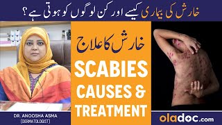 KHARISH KA ILAJ  Scabies Treatment In Urdu  Kharish Ki Bimari Kyun Hoti Hai  Itching Solution [upl. by Desdamona66]