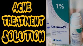 DermaT Clindamycin phosphate Topical Solution  How to get rid Acne  ACNE TREATMENT UPDATE [upl. by Fidelity]