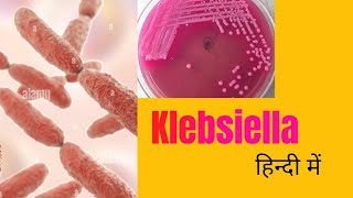 Klebsiella morphology pathogenesis lab diagnosis amp treatment in hindi [upl. by Darrin]