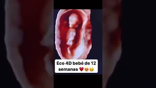 Ultrasonido 4D de bebé de 12 semanas 🥰 [upl. by Anih]