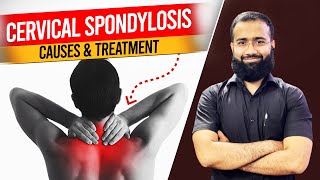 Cervical Spondylosis Treatment  Get Relief From Neck Pain  Cervical Pain Home Treatment [upl. by Noxaj957]