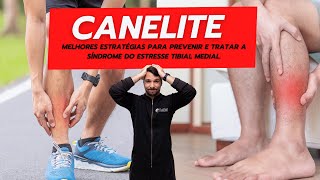 Canelite Melhores estratégias para prevenir e tratar a síndrome do estresse tibial medial [upl. by Eerrehc]