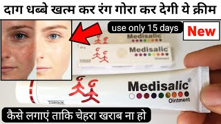 Medisalic Cream Review  how to use medisalic ointment cream [upl. by Guyon]