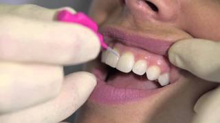 How to use an interdental brush  AJ Hedger [upl. by Carolin]