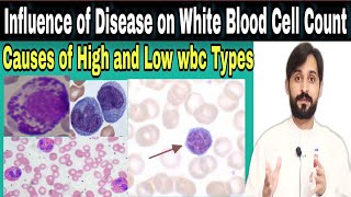 Influence of disease on white blood cell count  Causes of low and high wbc types [upl. by Garnes]