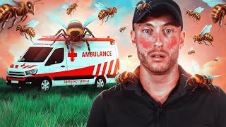 How I Dealt with Anaphylaxis [upl. by Frantz]