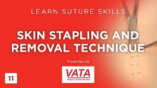 Skin Stapling and Removal Technique  Learn Suture Techniques  VATA [upl. by Thordis588]