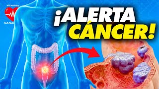 ¡Actúa YA quotSíntomas y Signos del Cáncer de Colon Prevención y Detección Tempranaquot [upl. by Fougere599]