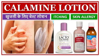 CALAMINE LOTION BEST LOTION FOR ITCHING SKIN ALLERGY खुजली के लिए बेस्ट लोशन MEDICATED LOTION [upl. by Bruner]