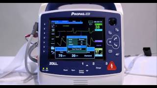 Propaq MD Pacing [upl. by Asyal]