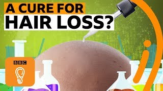 Why is there no cure for hair loss  BBC Ideas [upl. by Linder964]