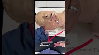 OROPHARYNGEAL AIRWAY INSERTION TECHNIQUE criticalcaremedicine emergencymedicine airwaymanagement [upl. by Nitsid]