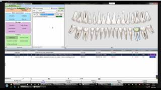 Visiodent L500 tutoriel réforme 100 Santé [upl. by Levana]