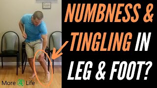 Numbness and Tingling In Leg and Foot [upl. by Else]