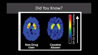 Lecture 12 The Neurobiology of Addiction From Use to Addiction [upl. by Feldman]