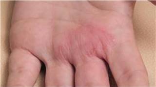 Dermatology Treatments  How to Diagnose Skin Rashes [upl. by Kristoforo]