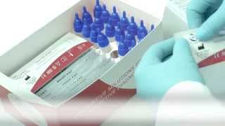 Rapid test for detection of rotavirus and adenovirus 4041 [upl. by Akinoj]