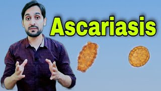 Ascariasis Infection  Ascaris Lumbricoides  Diagnosis  Life Cycle and Treatment [upl. by Azilem]