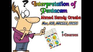 Pentacam Interpretation English [upl. by Macintosh]