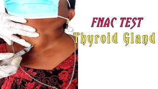 FNAC For Thyroid Gland।। [upl. by Idihc137]