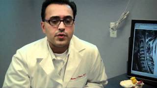 Meridian Neuroscience Cervical Spondylotic Myelopathy CSM Aasim S Kazmi MD [upl. by Yssej]