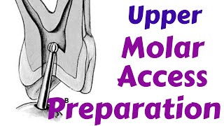 Upper Maxillary Molars  Endodontic Access cavity Preparation Endodontic Lecture amp Tutorial [upl. by Oelgnaed]