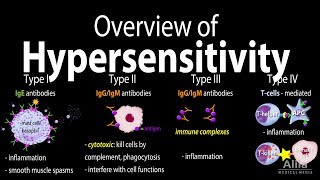 Hypersensitivity Overview of the 4 Types Animation [upl. by Hearn638]