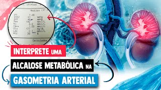 GASOMETRIA ARTERIAL de uma ALCALOSE METABÓLICA │ Medicina Resumida [upl. by Gnoht]