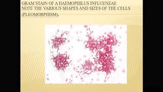 Gram negative bacteria Haemophilus influenzae [upl. by Brande]