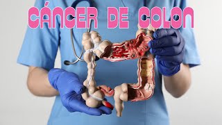 🔴 Alerta Lo que DEBES saber sobre el Cáncer de Colon [upl. by Ased361]