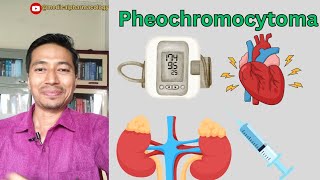 Pheochromocytoma  Cause Symptoms And Treatment  medicalpharmacology mbbs [upl. by Aleece]