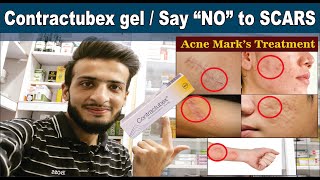 Contractubex gel  Get rid of SCARS Quickly  Uses amp Sid effects  Acne Scars Treatment  O Beauty [upl. by Base]