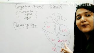 Ventricular septal defect congenital heart diseaseeasy explanation in hindi [upl. by Blalock]