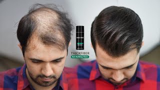 Hair Style For Very Thin amp Balding Hair by using Hair Fibers 2022 [upl. by Larrie]