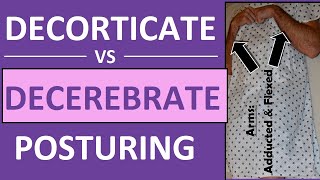 Decerebrate vs Decorticate Posturing Rigidity Mnemonic amp Pictures Nursing NCLEX [upl. by Danell]