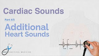 Additional Heart Sounds Pt 45 Cardiac Sounds Series [upl. by Torrin85]