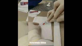 Aula Prática  Hematologia Clínica 🩸shorts study farmacia [upl. by Bilac900]