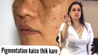 Parul Garg “ How to cover pigmentation “  Makeup by Parul Garg  Parul Garg makeup studio [upl. by Airamesor]