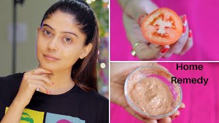 Monsoon Beauty tips  Rinkal Soni [upl. by Nawk]