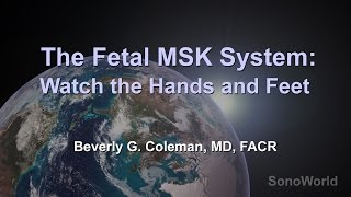 quotThe Fetal MSK System Watch the Hands and Feetquot Ultrasound SonoWorld Lecture [upl. by Faun]