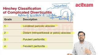 Hincheys classification of diverticulitis For MBBS students Neet PG Usmle FMGE I NEET PG USMLE [upl. by Akehsay]