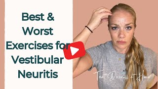 Best and Worst Vertigo Exercises for Vestibular Neuritis [upl. by Autrey]