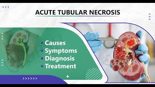 Acute Tubular Necrosis Symptoms and Causes  Diagnosis  Treatment  Prevention [upl. by Declan500]