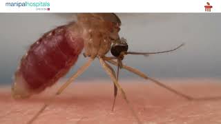 Chikungunya Symptoms Prevention and Treatment  Dr Manoj Kumar CH  Manipal Hospital Vijayawada [upl. by Everett665]