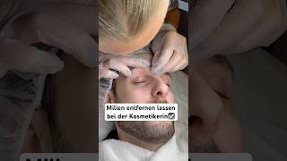 Milien entfernen☑️ hautpflege skincare gesichtsbehandlung kosmetiker ausreinigen [upl. by Siuoleoj495]