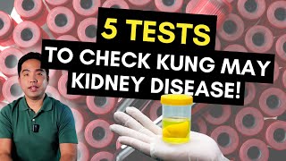 5 Tests Para Malaman Kung May Kidney Disease [upl. by Naniac]